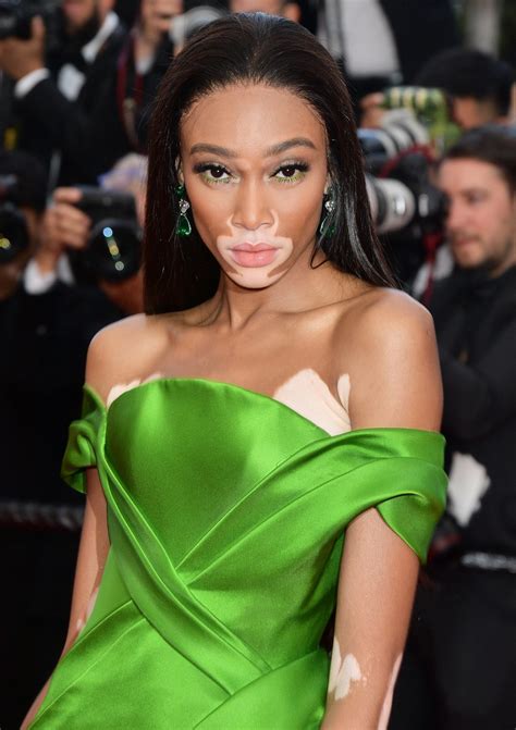 winnie harlow net worth|Winnie Harlow Biography: Husband, Net Worth,。